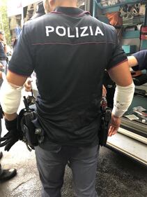Milano, si dà fuoco in strada: le foto degli agenti feriti 8