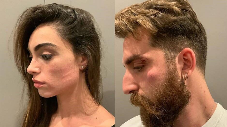 Lorella Boccia e Niccolò Presta derubati e minacciati con un coltello: "Uomini di m..."