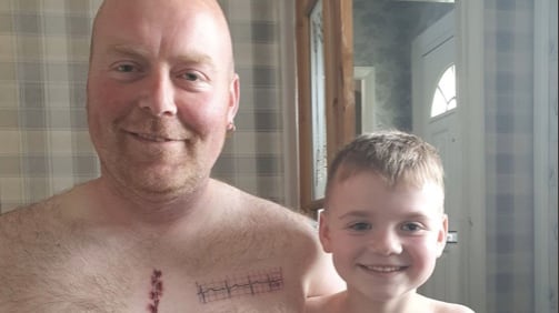 Il figlio è stato operato: padre si tatua una cicatrice come la sua