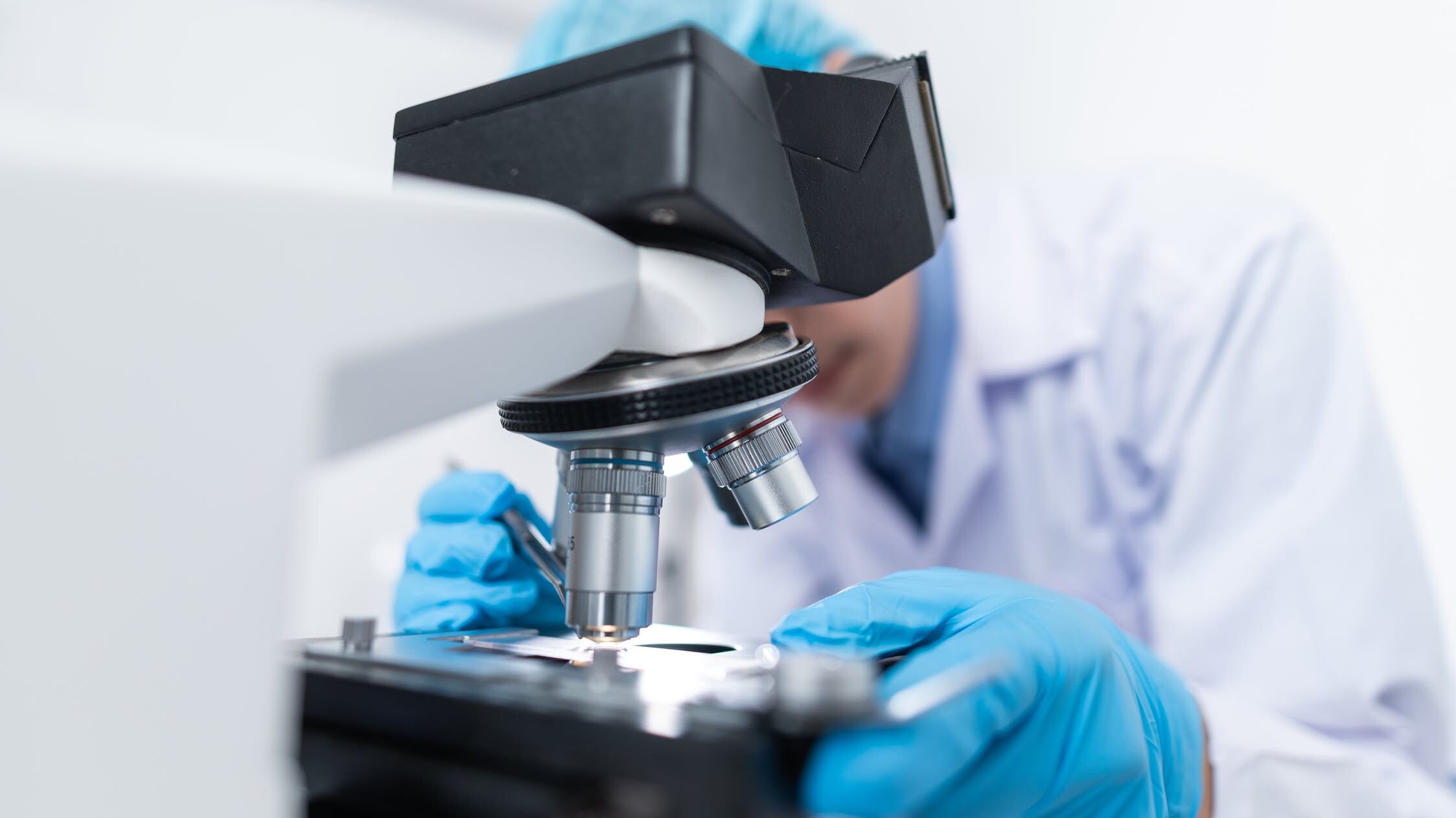 Immunoterapie, così riducono la progressione del melanoma del 25%