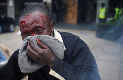 Kenya: polizia usa gas lacrimogeni contro i manifestanti 2