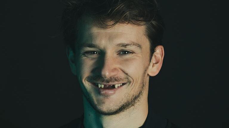 "Sorrido perché recupero i denti dopo 40 giorni": con la foto rivela le botte