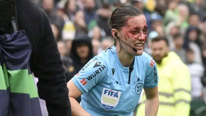 Il guardalinee, il volto pieno di sangue e il trauma: cos'è successo in Liga