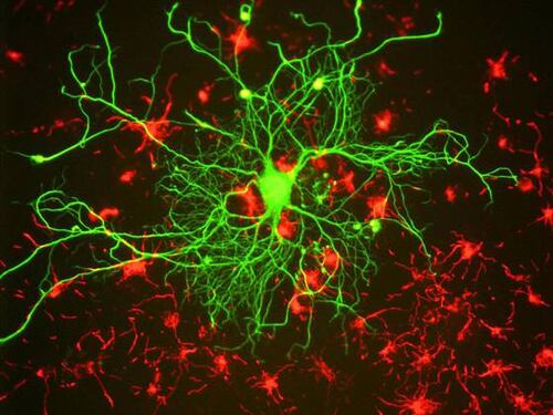 Scoperto il gene che sconfigge il parkinson
