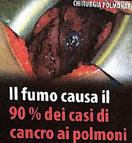 Le "immagini choc" sui pacchetti di sigarette 6