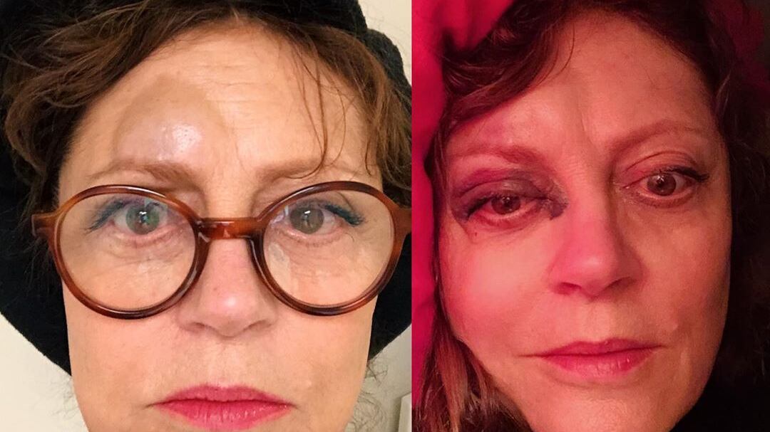 Brutto incidente per Susan Sarandon: commozione cerebrale e naso rotto