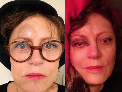 Brutto incidente per Susan Sarandon: commozione cerebrale e naso rotto