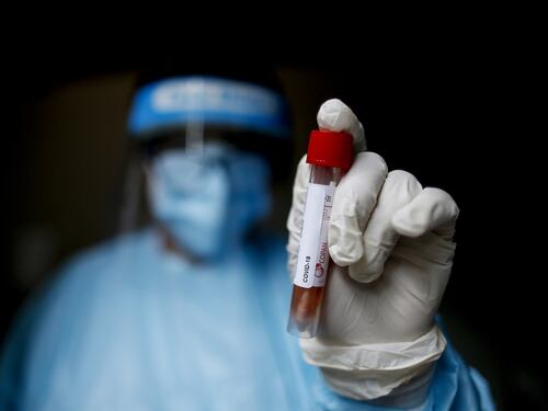 Coronavirus, studio conferma: "Ci si può contagiare più volte"