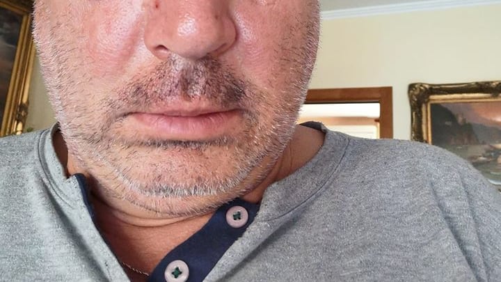 "Pugni e calci, erano in quattro". Aggredito il consigliere leghista