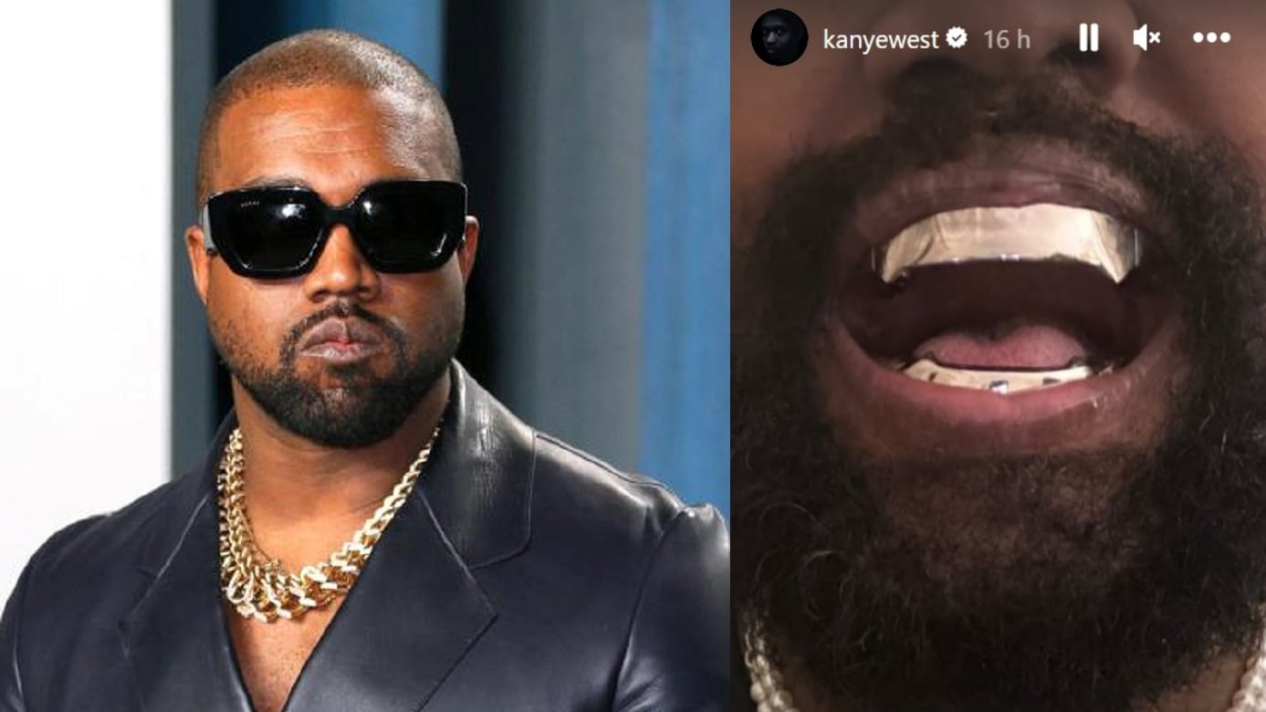 "Protesi di titanio al posto dei denti". L'ultima follia di Kanye West