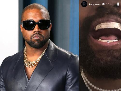 "Protesi di titanio al posto dei denti". L'ultima follia di Kanye West