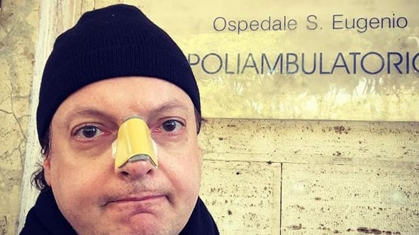 Dado dopo l'aggressione: "30 giorni di prognosi, aspetto si pronunci la procura"