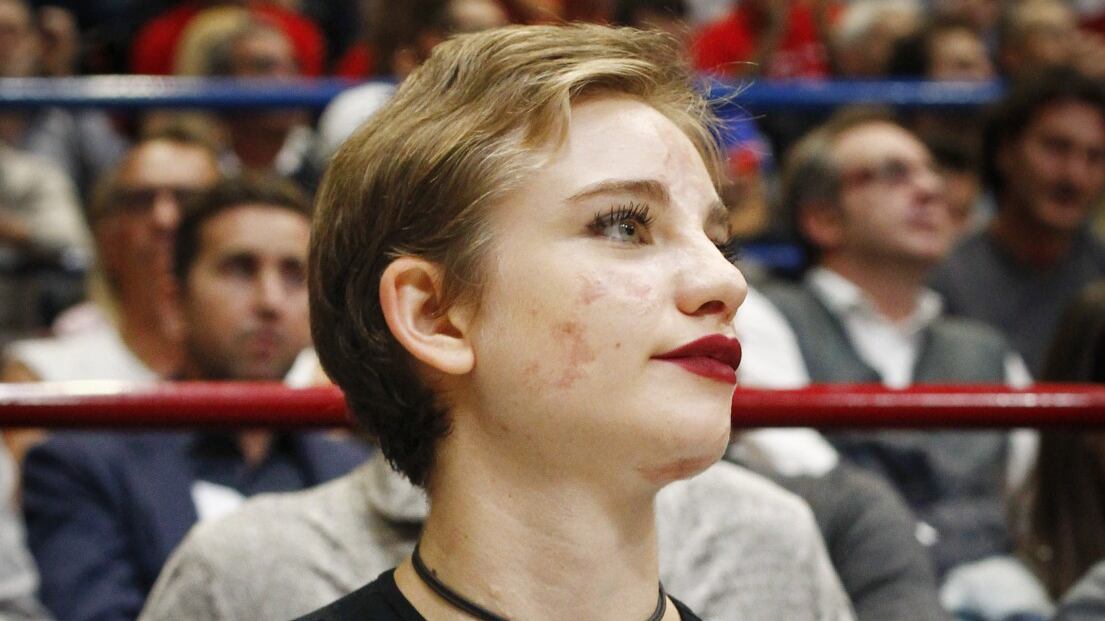 Bebe Vio: “Fossi stata vaccinata, non avrei preso la meningite"