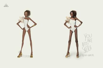 La nuova scioccante campagna contro l'anoressia 1