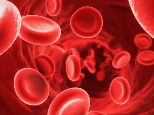 Bimbo salvato da allergia con il lavaggio del sangue