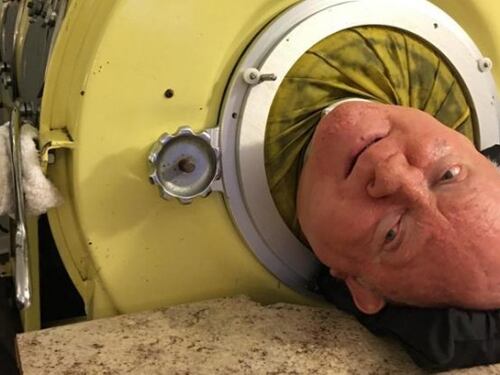 Paul Alexander: addio all'uomo che ha vissuto 70 anni nel polmone d'acciaio