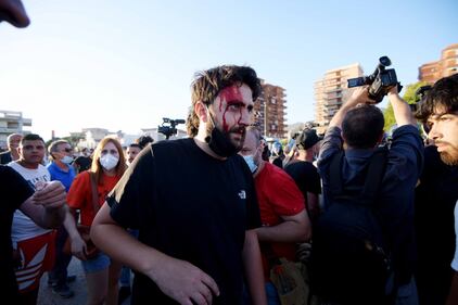 Matteo Salvini contestato a Mondragone, un ferito  9