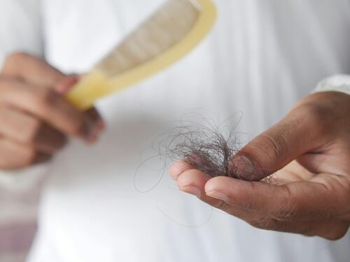 Alopecia da stress: ecco come riconoscerla
