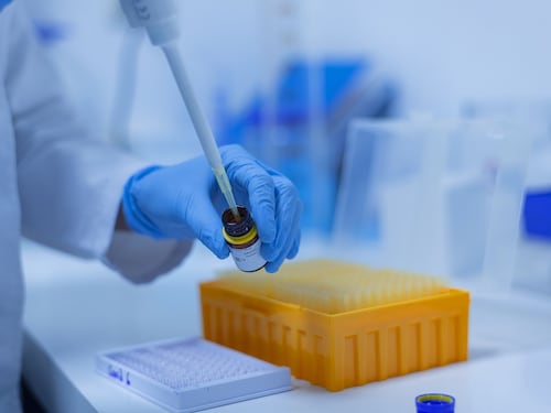 Leucemia mieloide acuta, svelato il meccanismo del metabolismo individualizzato