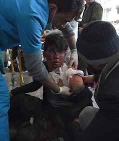I feriti nell'attentato di Kabul 8