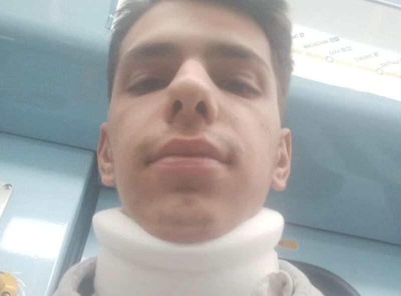 Ragazzo pestato a sangue in metropolitana dalle guardie del corpo di una borseggiatrice 5