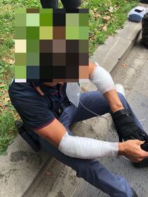 Milano, si dà fuoco in strada: le foto degli agenti feriti 2