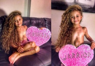 Nata con il cuore e l'intestino fuori dal corpo: ora l'intervento per salvarle la vita 2