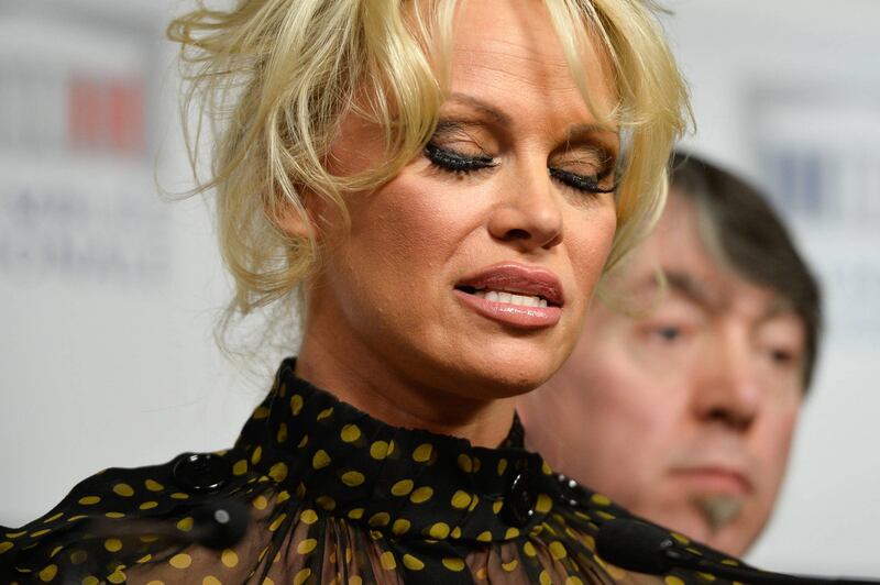 Pamela Anderson contro il foie gras 29