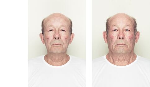 Il profilo migliore: le fotografie che raddoppiano solo una metà del volto 11