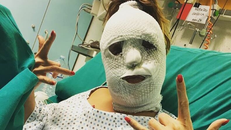 Foto choc di Gessica Notaro dopo l'attacco con l'acido: "Mi ha salvato la mia follia"
