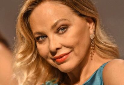 Così il botox ha trasformato le star 2