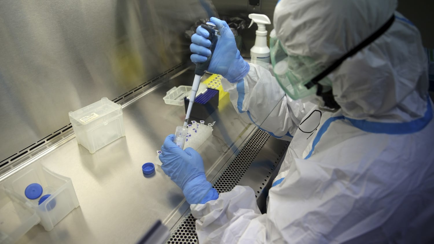 Lattoferrina contro il Covid? "Mangia il nutrimento del virus"