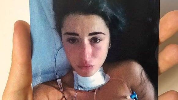 "La dieta Auschwitz non la faccio". Scoppia la bufera sulla Vignali