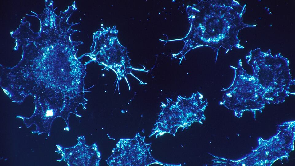Immunoterapia per i tumori. Italiana la scoperta della svolta