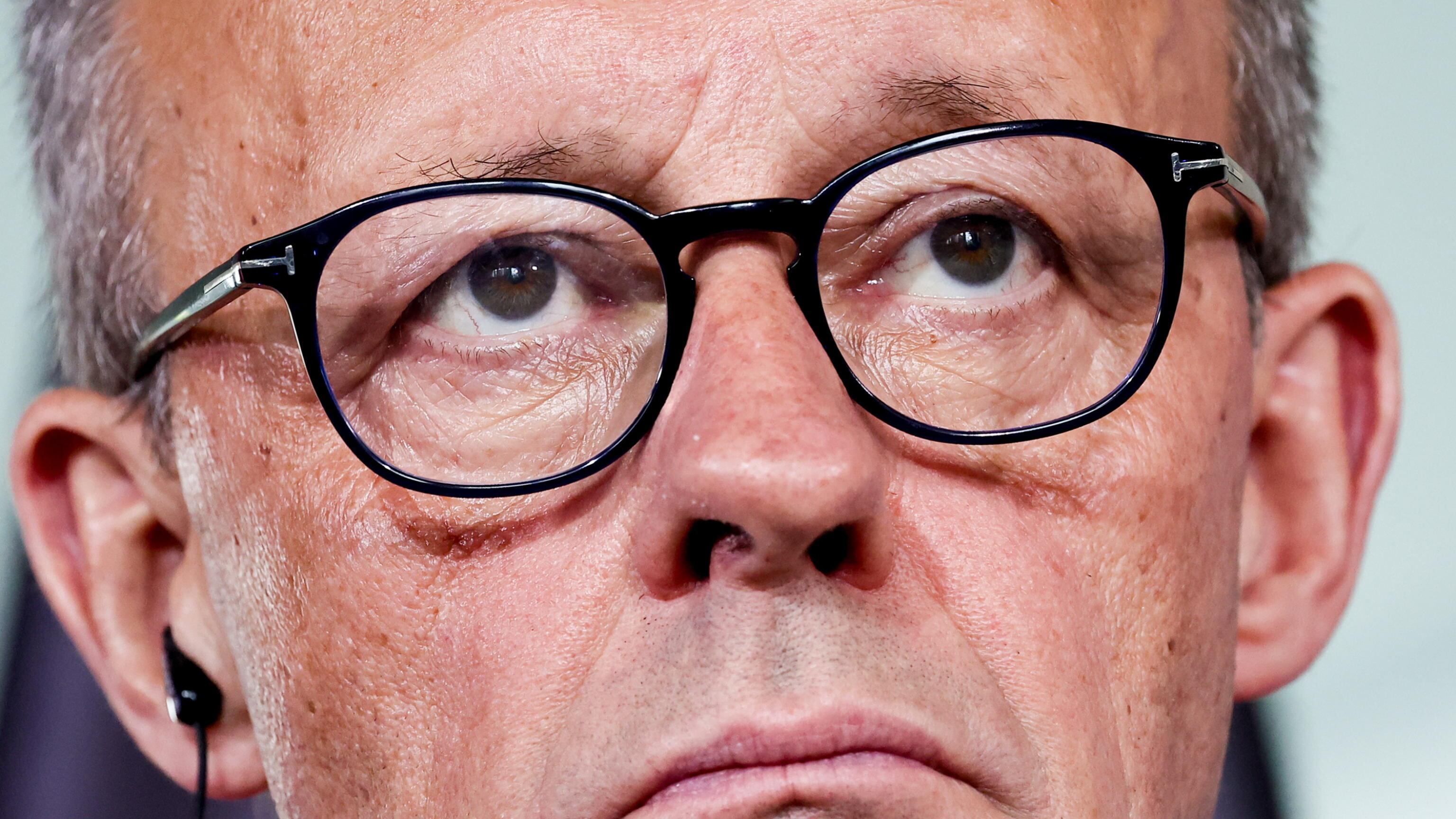 Merz respinge Unicredit: "Scalata inaccettabile"