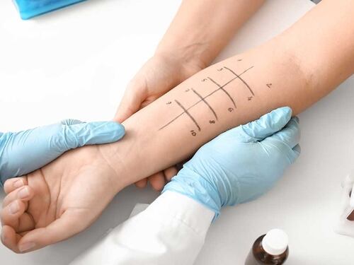 Quali test fare per valutare se si è allergici?