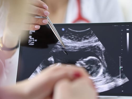 Chirurgia, si rompe l'aorta e viene operata con il bimbo in utero, intervento record a Milano