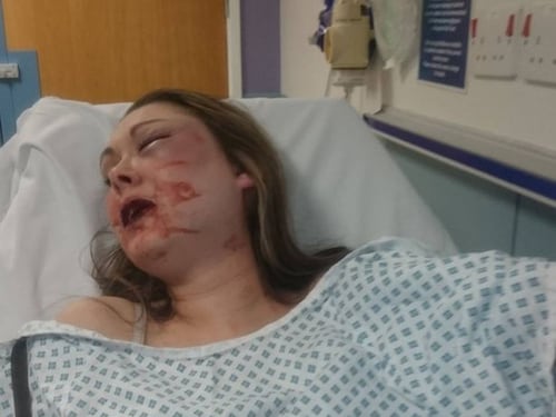 Donna picchiata brutalmente dal marito perché si è rifiutata di avere un rapporto con lui