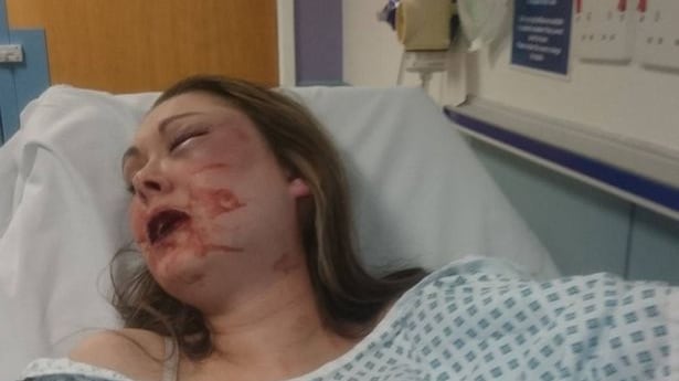 Donna picchiata brutalmente dal marito perché si è rifiutata di avere un rapporto con lui