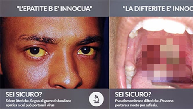 Vaccini, foto choc sulle malattie "Così muore chi non si vaccina"