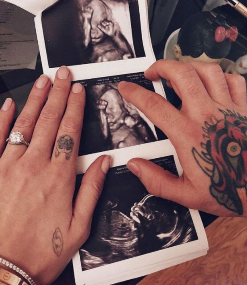 Fedez e Chiara Ferragni, le immagini più belle 7