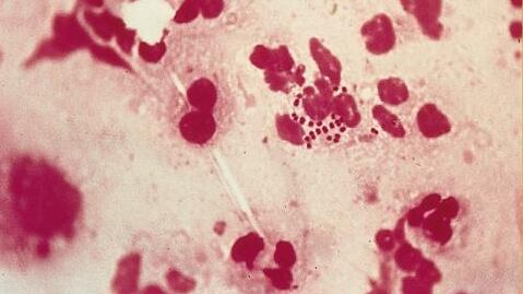 L'Oms lancia l'allerta, sempre più preoccupazione per la Gonorrea: "È resistente agli antibiotici"