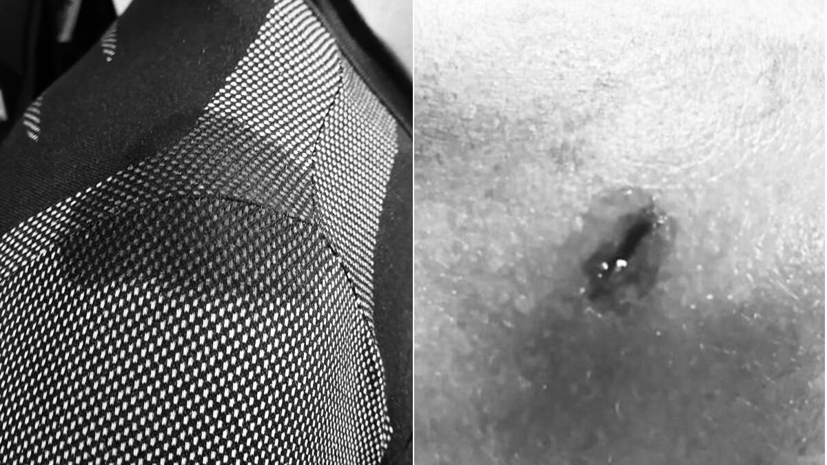 “Quale è il livello di sopportazione della violenza?”. A Udine agente ferito colpito da un coltello