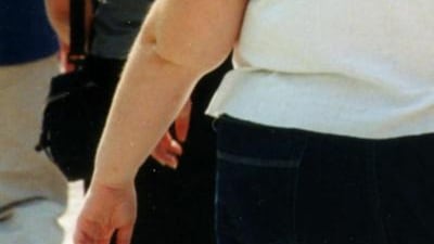 Giornata dell'alimentazione, obesità in aumento: +36% negli ultimi venti anni