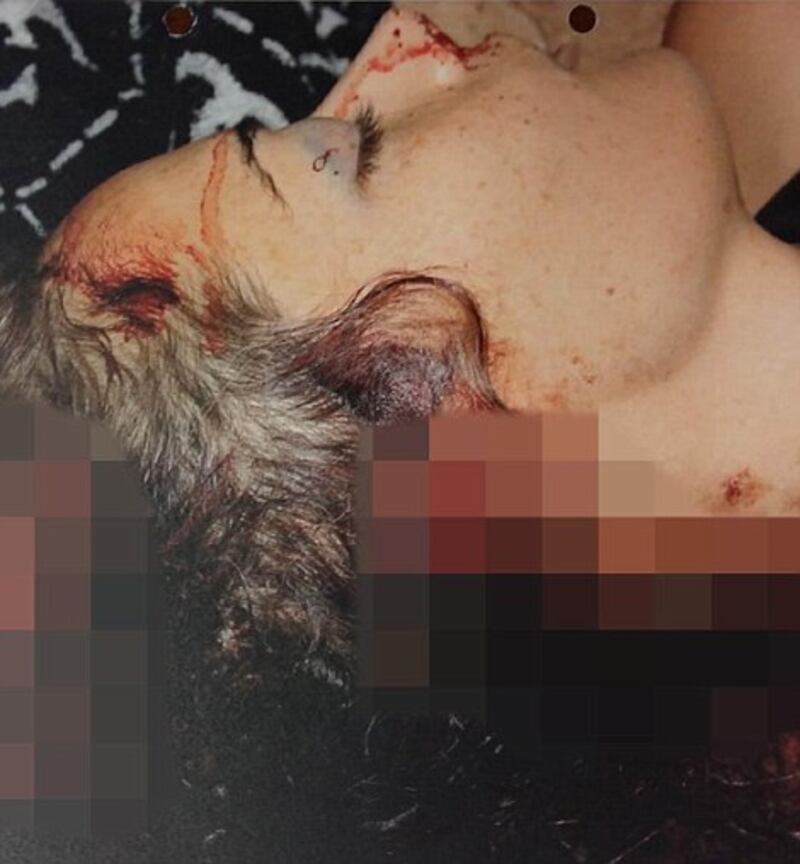 Ecco le foto dell'omicidio di Reeva Steenkamp  1