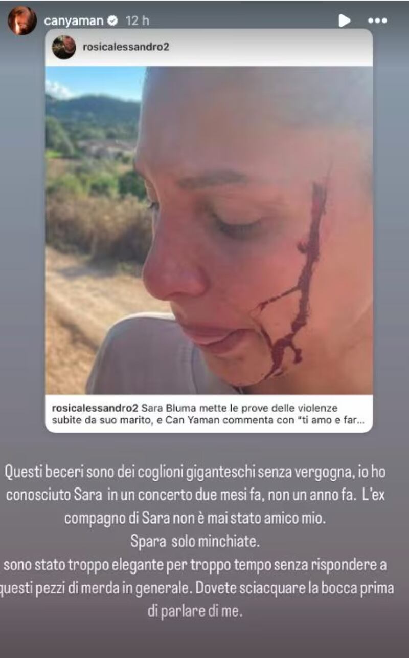 La storia Instagram pubblicata da Can Yaman