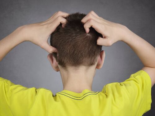 Pidocchi: cosa sono, come riconoscerli e i rimedi per liberarsene