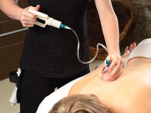 Cupping therapy, il trattamento che stimola la circolazione sanguigna