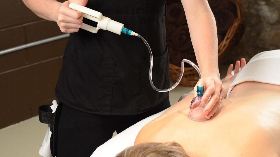 Cupping therapy, il trattamento che stimola la circolazione sanguigna