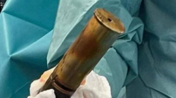 Choc in ospedale: così l'anziano ha fatto scattare l'allarme bomba